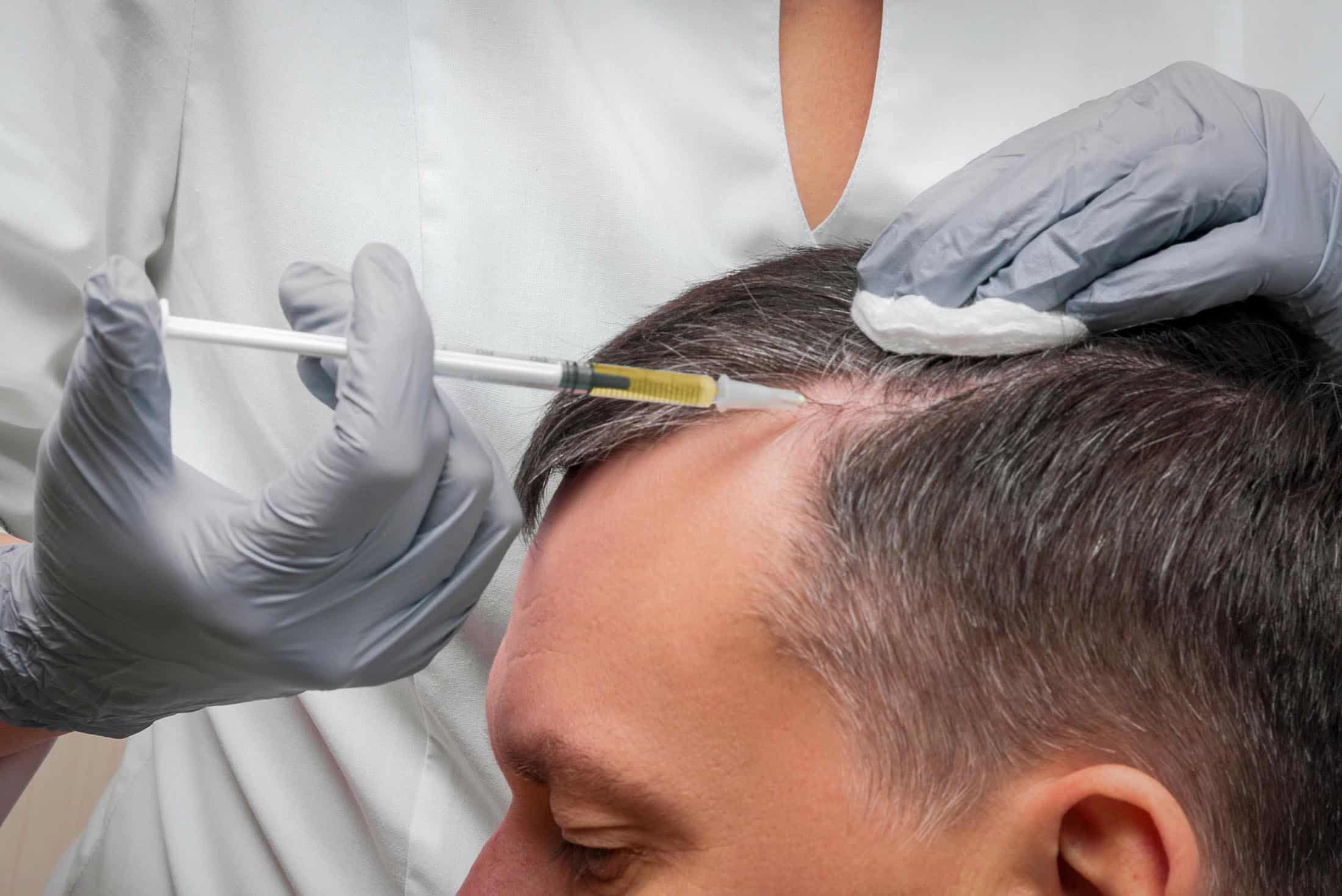 Injection, Treatment for Hair Loss